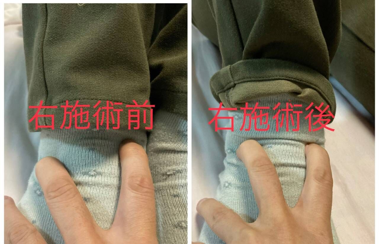 関節専門院こたろうです。